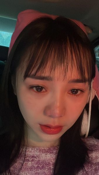 Đôi mắt đỏ hoe của gái xinh