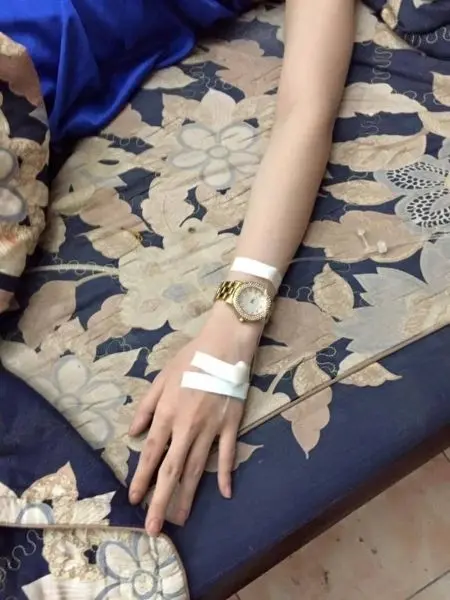 Truyền nước ở tay nữ với ánh sáng tự nhiên nhẹ nhàng Truyền nước ở tay nữ với ánh sáng tự nhiên nhẹ nhàng
