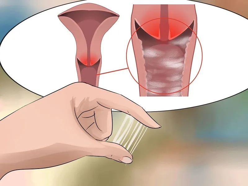 Cảnh báo, nhận biết viêm âm đạo do vi khuẩn qua hình ảnh 5