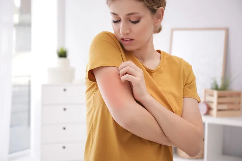 Thư viện hình ảnh Viêm mô tế bào, cập nhật mới nhất 14