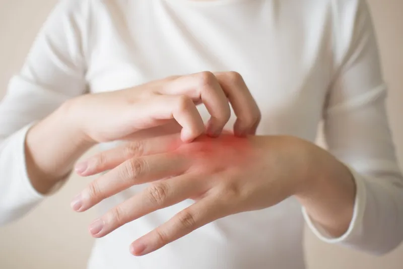 Thư viện hình ảnh Viêm mô tế bào, cập nhật mới nhất 12