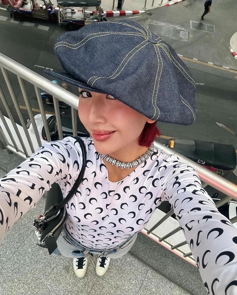 Sự thay đổi của Quỳnh Anh Shyn phẫu thuật