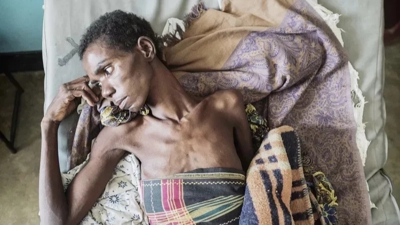 Thực trạng bệnh AIDS sống được bao lâu với điều trị hiện nay