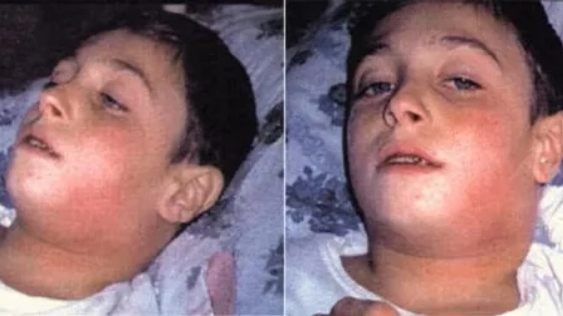 Biểu hiện bệnh bạch hầu ở trẻ em với dấu hiệu mệt mỏi