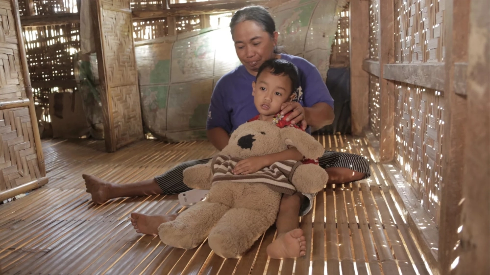 Các di chứng bệnh bại liệt về cơ xương khớp vĩnh viễn