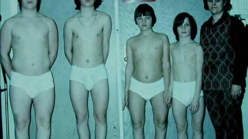 Tìm hiểu nguyên nhân bệnh còi xương do dinh dưỡng