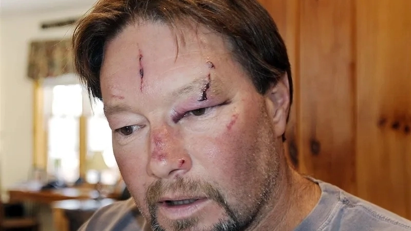 Hình ảnh virus dại dưới kính hiển vi điện tử