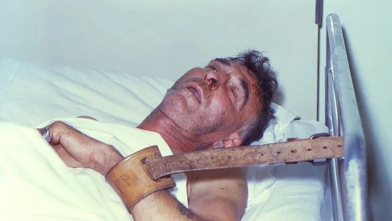 Các dấu hiệu chó bị dại bao gồm thay đổi hành vi, hung dữ bất thường, chảy nước dãi và liệt hàm