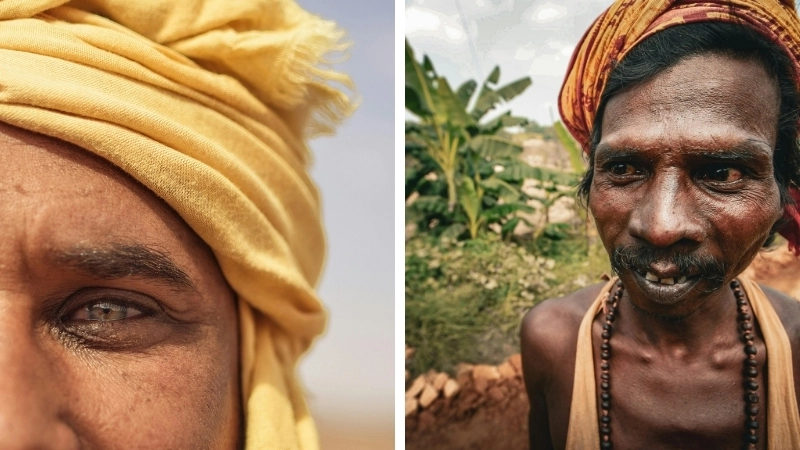 Giải thích bệnh đau mắt hột là gì qua hình ảnh lâm sàng