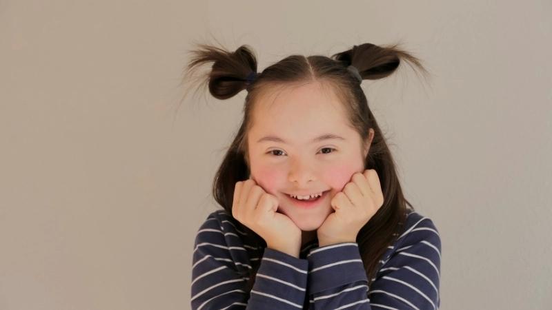 Đặc điểm lòng bàn tay có một rãnh sâu duy nhất của trẻ bị bệnh Down