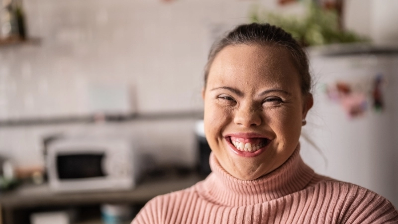 Các dấu hiệu trẻ bị bệnh Down điển hình trên khuôn mặt và bàn tay