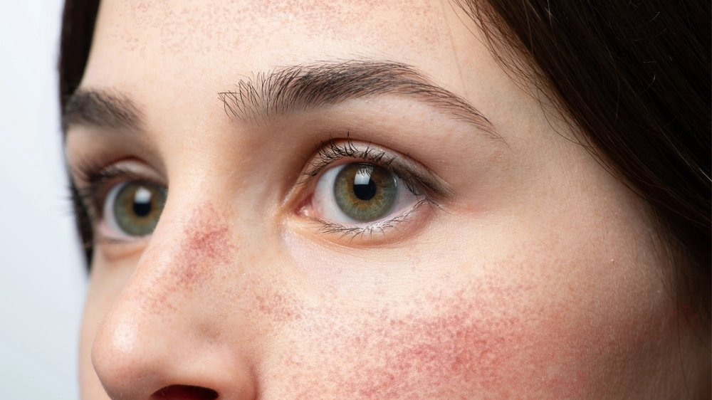 Các giai đoạn phát triển của hồng ban đa dạng