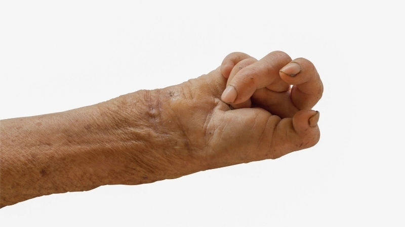 Vi khuẩn Hansen dưới kính hiển vi điện tử