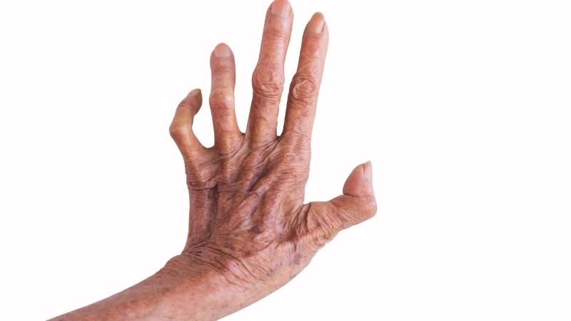 Cuộc sống của bệnh nhân tại các trại phong trước đây