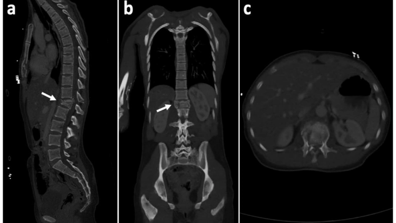 Phân biệt nốt nổi mẩn ngứa như sán chó