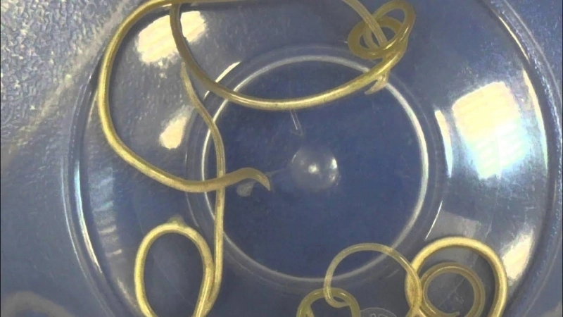 Hình ảnh mô phỏng ấu trùng sán chó lên não