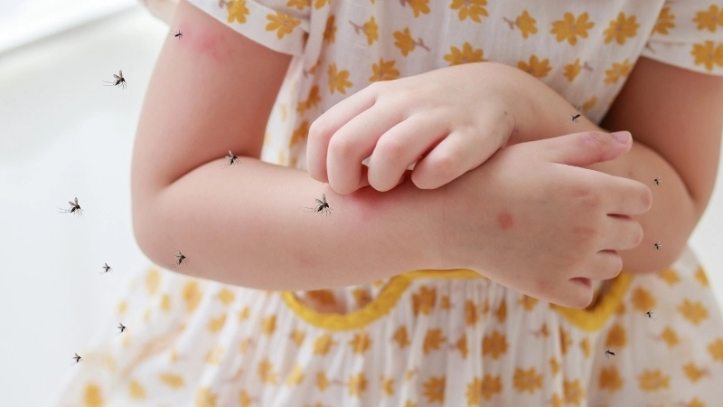 Bảng so sánh để phân biệt sởi và sốt xuất huyết