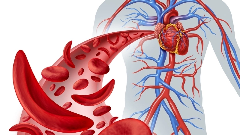 Sơ đồ di truyền của người mang gen Thalassemia