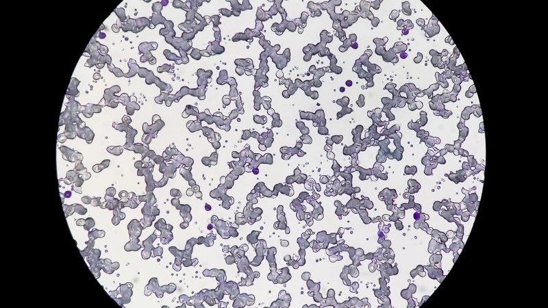 Sơ đồ minh họa di truyền để giải thích bệnh Thalassemia là gì