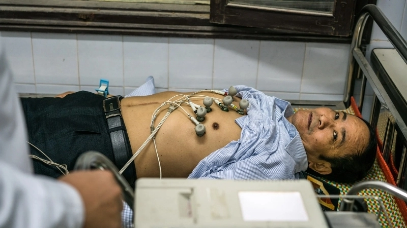 Cơ chế hình thành bệnh mạch vành