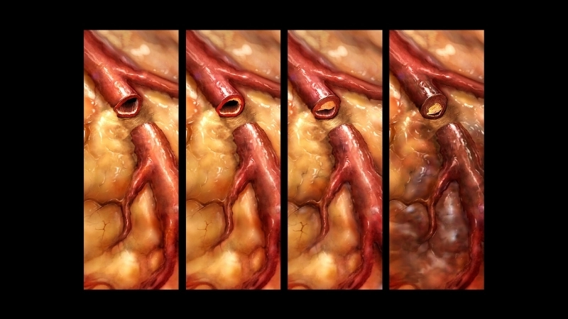 Biểu đồ theo dõi sức khỏe tim mạch tại nhà