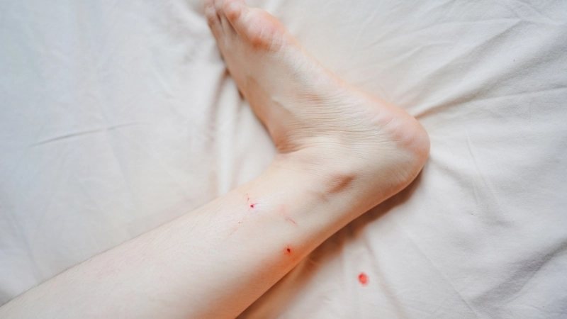 Cách xử lý khi bị đinh rỉ sét đâm có sao không