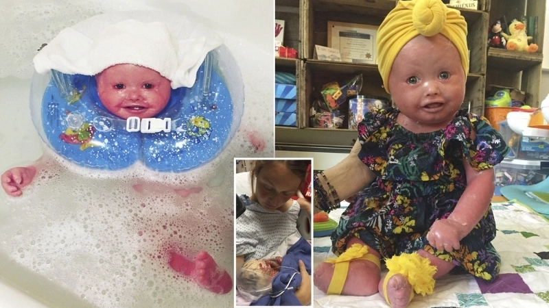 Các loại thuốc bôi trị bệnh vảy cá được bác sĩ chỉ định