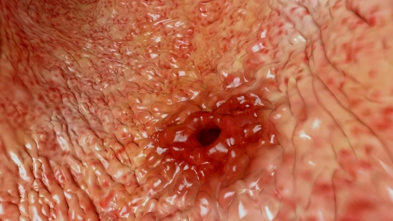 Hình ảnh vi khuẩn HP, nguyên nhân viêm loét dạ dày hàng đầu, dưới kính hiển vi.