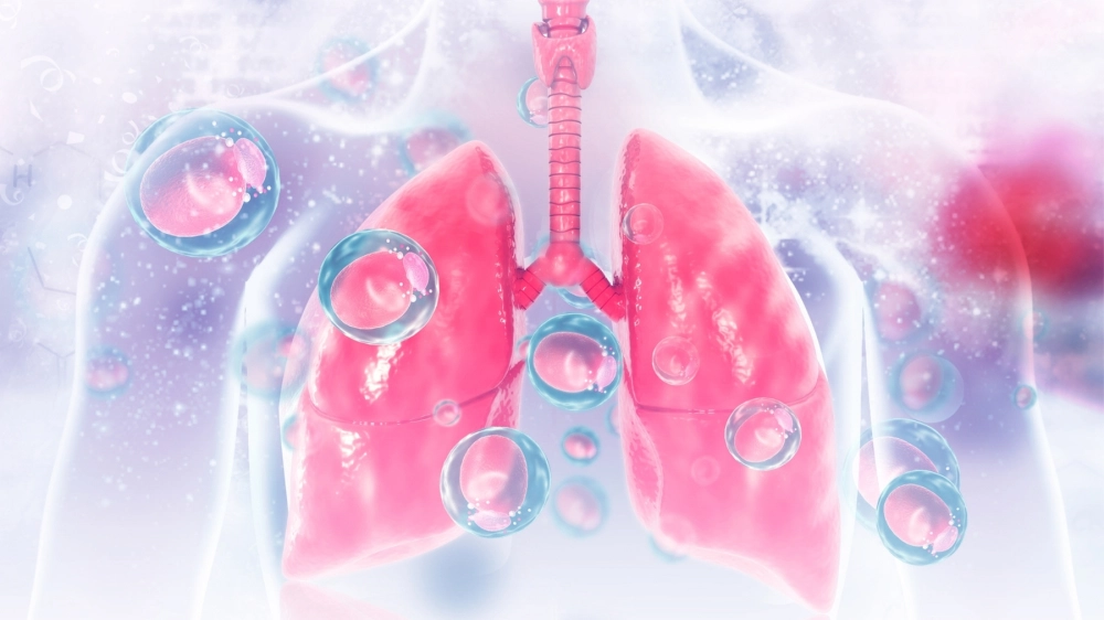 Các cách điều trị viêm phổi tại nhà an toàn