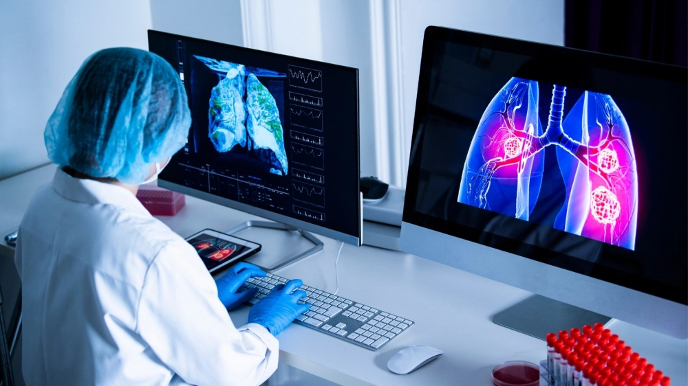 Tầm quan trọng của việc chụp X-quang phổi