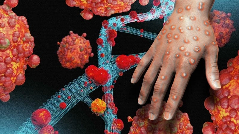 Hình ảnh tổng quan về bệnh đậu mùa khỉ