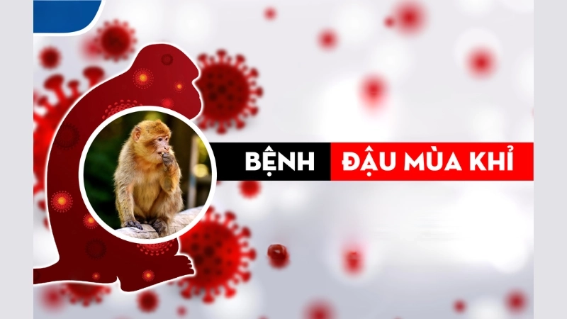 Hình ảnh bệnh đậu mùa giúp nhận biết sớm