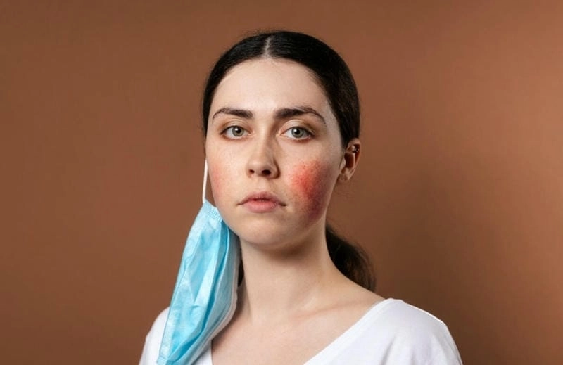 Trẻ bị nấm da mặt cần chăm sóc đúng cách